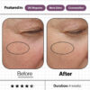 Skin Ultimate Before and After