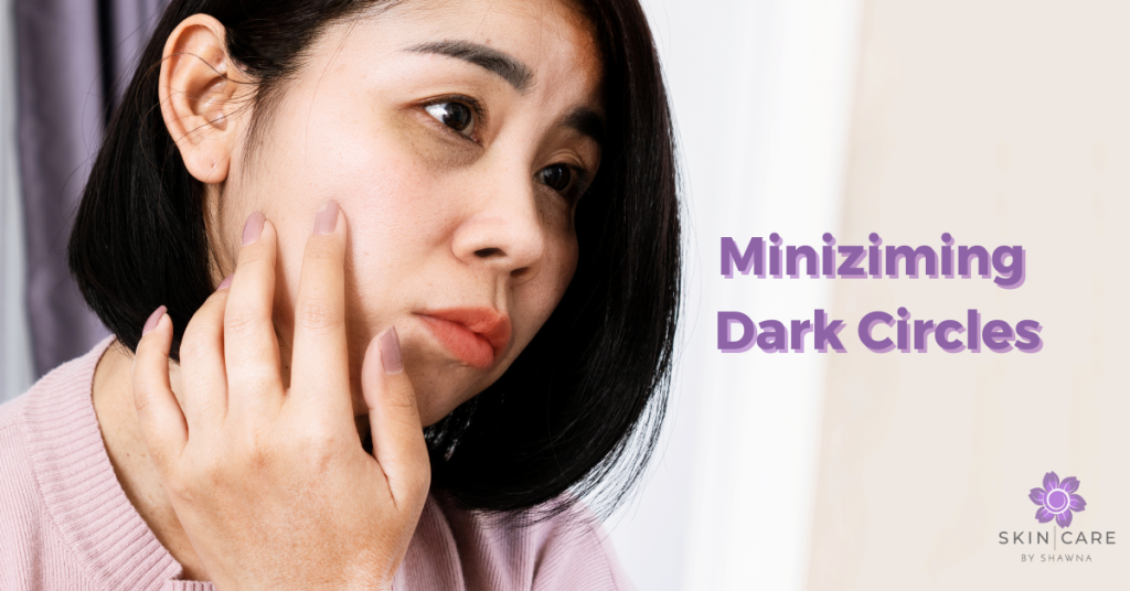 How to Minimize Dark Circles Under the Eyes