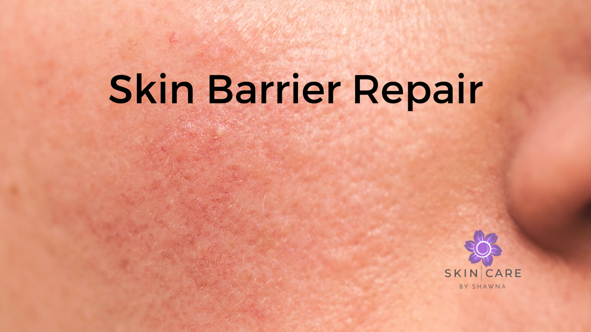 Barrier Repair: Why Skin Sometimes Looks Worse Before It Gets Better