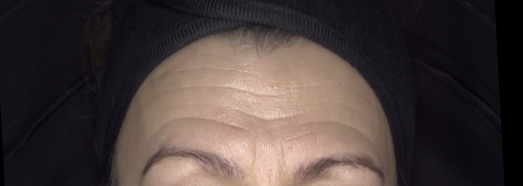 T_Jan_17_2026_Before