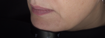 T_Lower_Before_Jan_17_2026