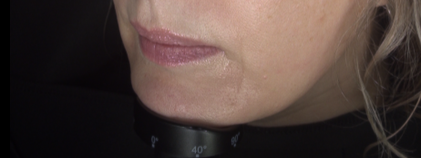 T_Lower_March_3_2026_Session 11